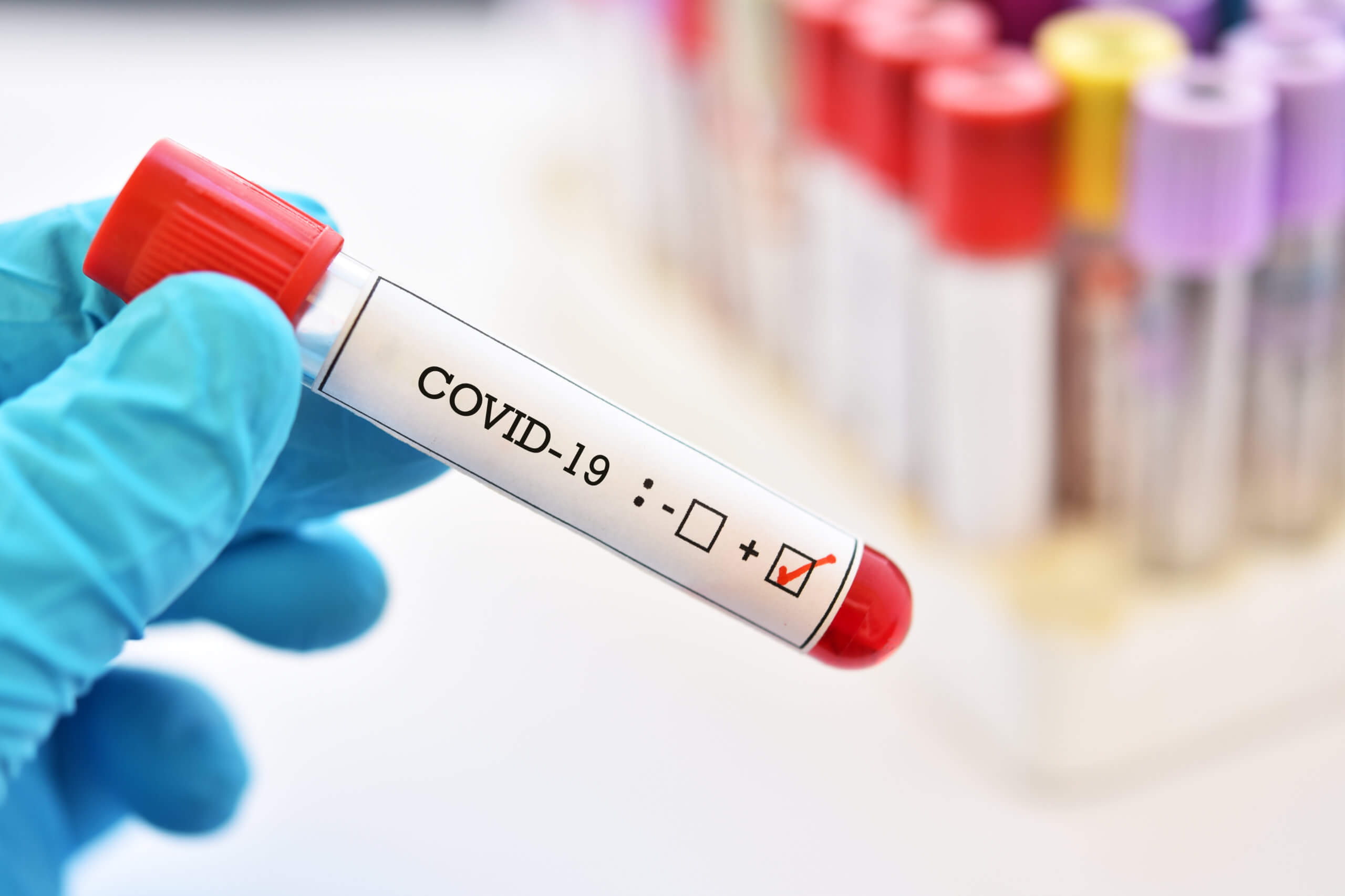 Family Emergency Room opens COVID-19 testing to non-symptomatic ...